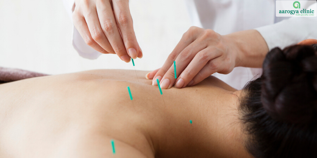 Acupuncture Treatment Near Me in Vellore, Acupuncture and Massage