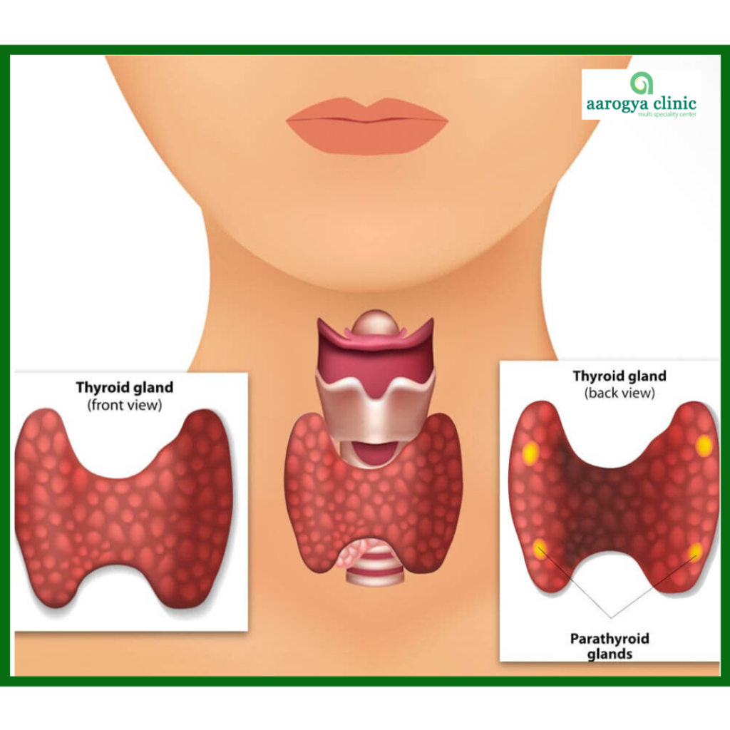 Best thyroid clinic in Vellore